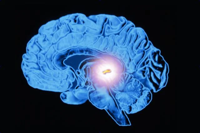pineal-gland.jpg