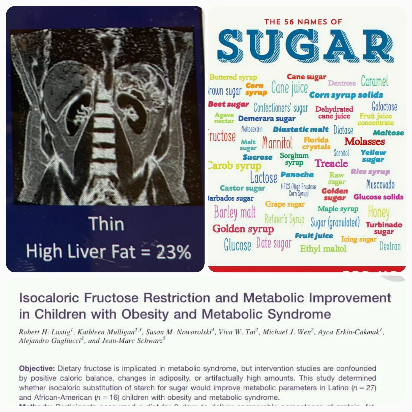 A Calorie Is A Calorie - Or Is It - Sugar.jpg