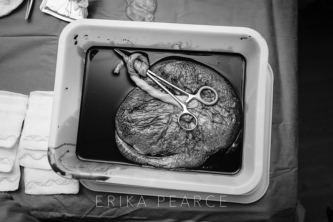 Erika Pearce Photography | Birth Experience Session | Louisiana | Northshore | Nola | Mandeville | Covington | Newborn Baby Birth Labor Placenta Photoshoot