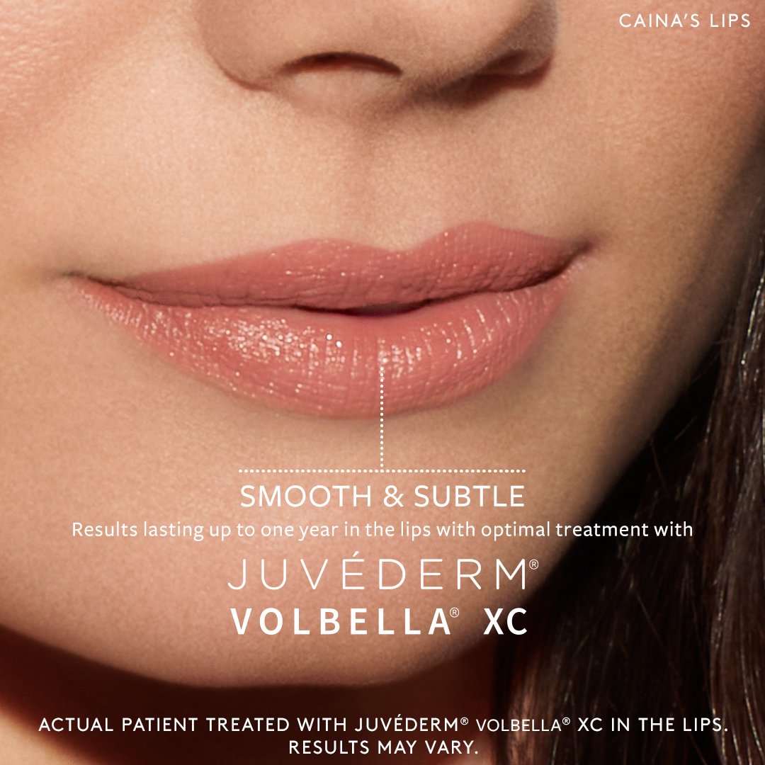 JUV-SM-147270-JUV-Lips-Summer-2021-Model-Assets_caina_FB.jpg