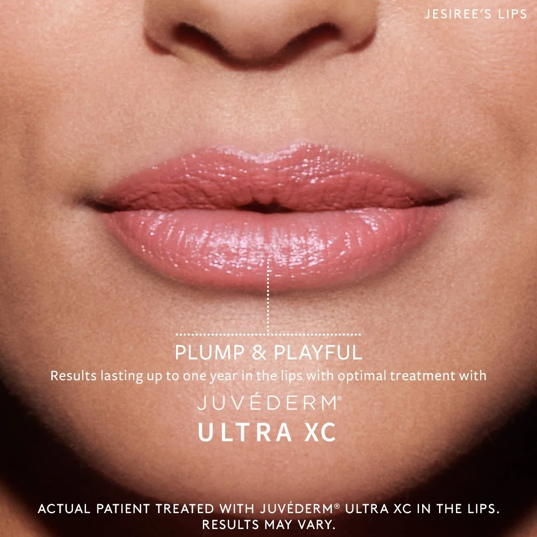 JUV-SM-147270-JUV-Lips-Summer-2021-Model-Assets_jesiree_FB.jpg