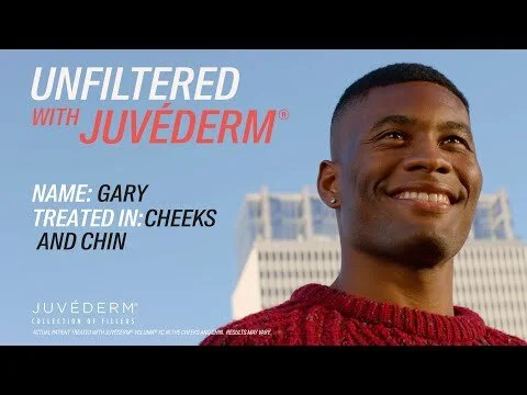 Why Gary Now Loves His Results With JUVÉDERM®