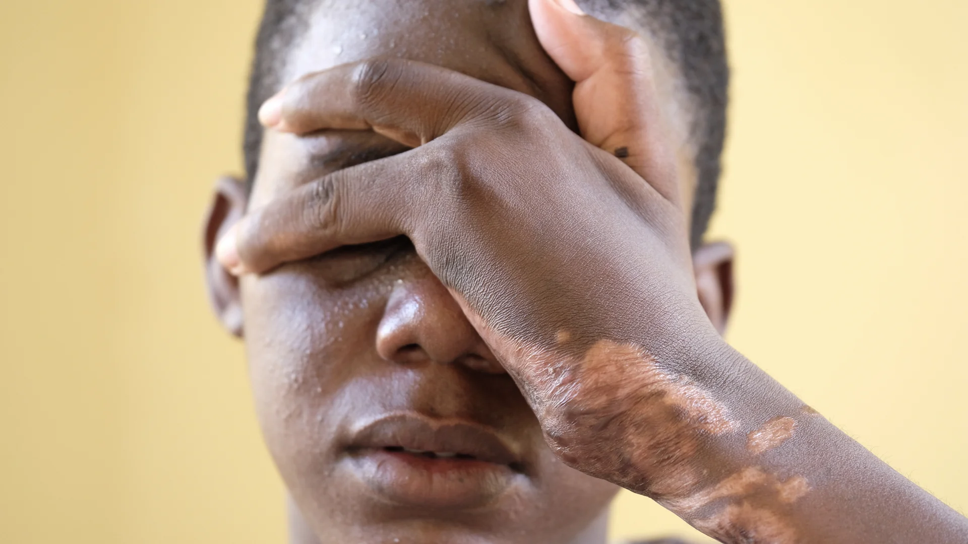 Sala was injured in the crisis. He was arrested and thrown in the truck on to broken glass. After three days of driving the desert, he was so badly injured his arm had to be amputated. He's now trying to get back to his home. Sala also lost two fing…