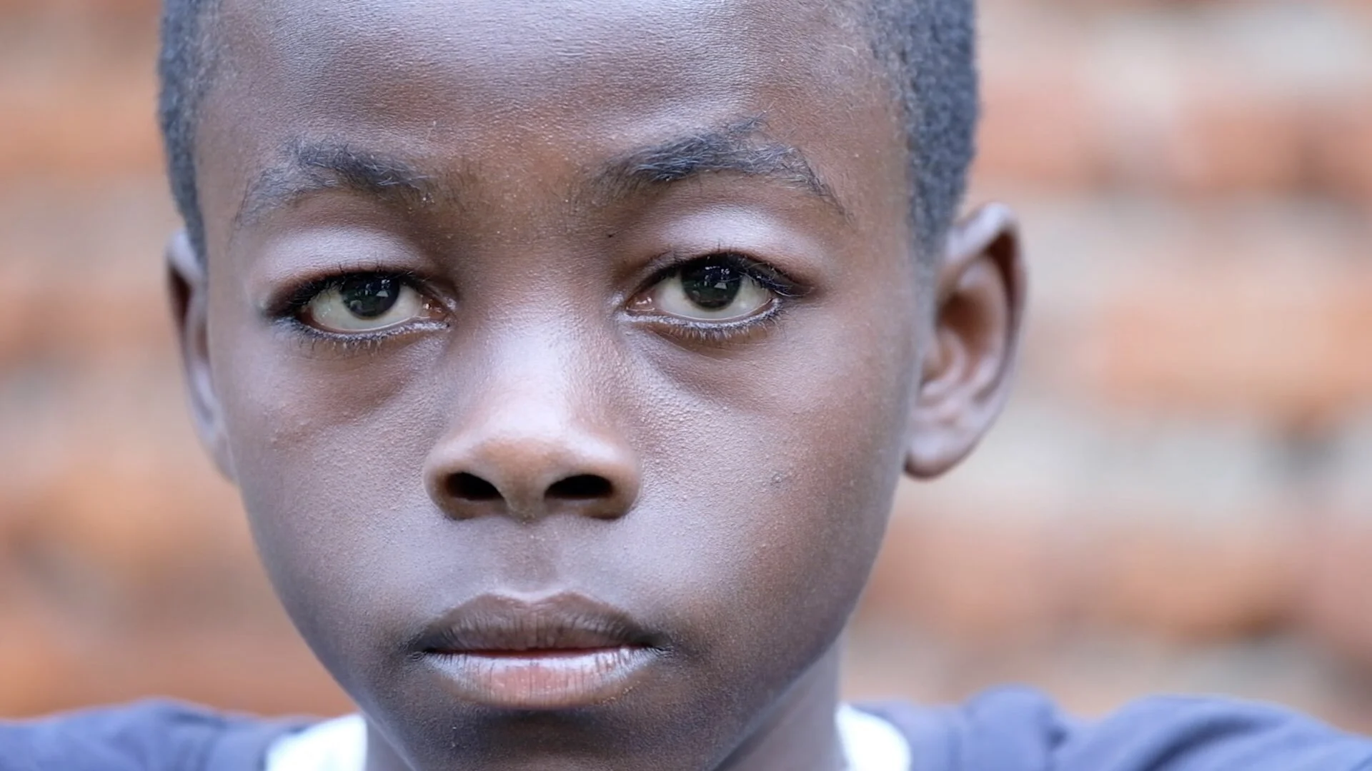 Honoré got Ebola after his sister died of the disease. He went to get vaccinated but was already infected. He’s a survivor who has struggled with fear and mistrust from his school mates.