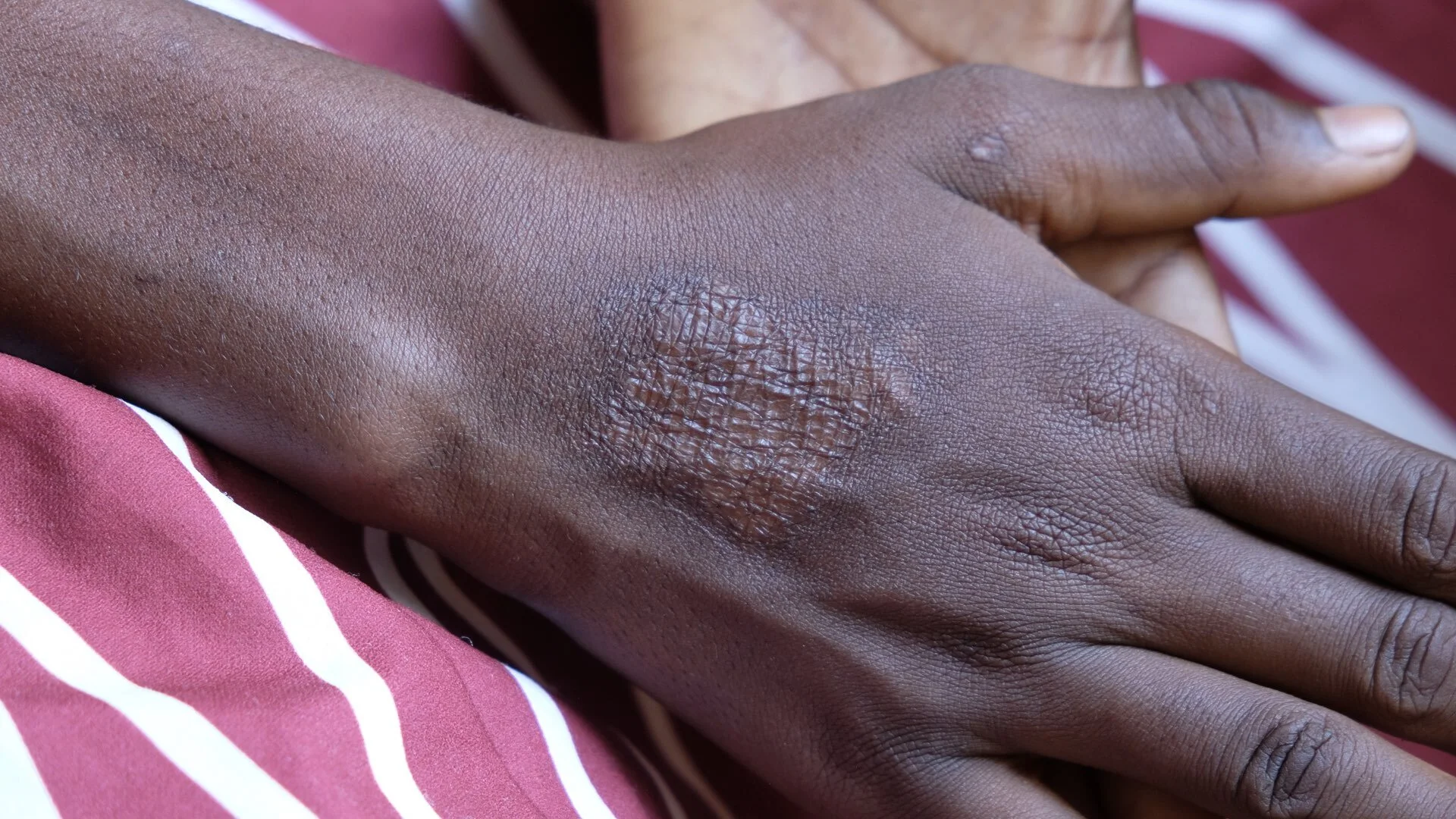 Jessica is 11 years old and lives in a state run orphanage outside Abuja. She was living with her aunt and coping with regular beatings, but one night her aunt took a hot knife from the fire and burned Jessica’s hand. The next day at school she was …