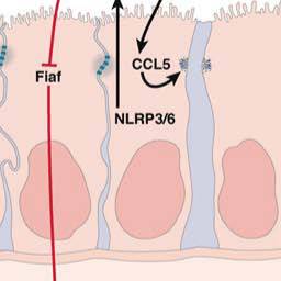 Effects of the Intestinal Microbiota on NAFLD and Progression to Steatohepatitis R