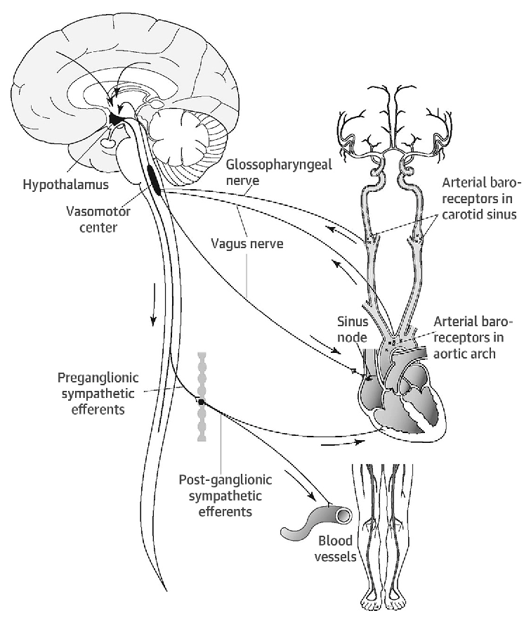 what causes hyperadrenergic pots