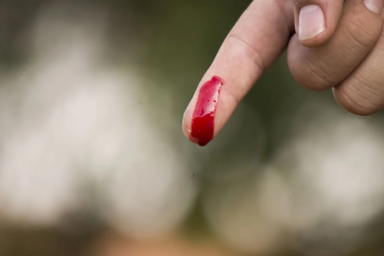 wound finger.jpg