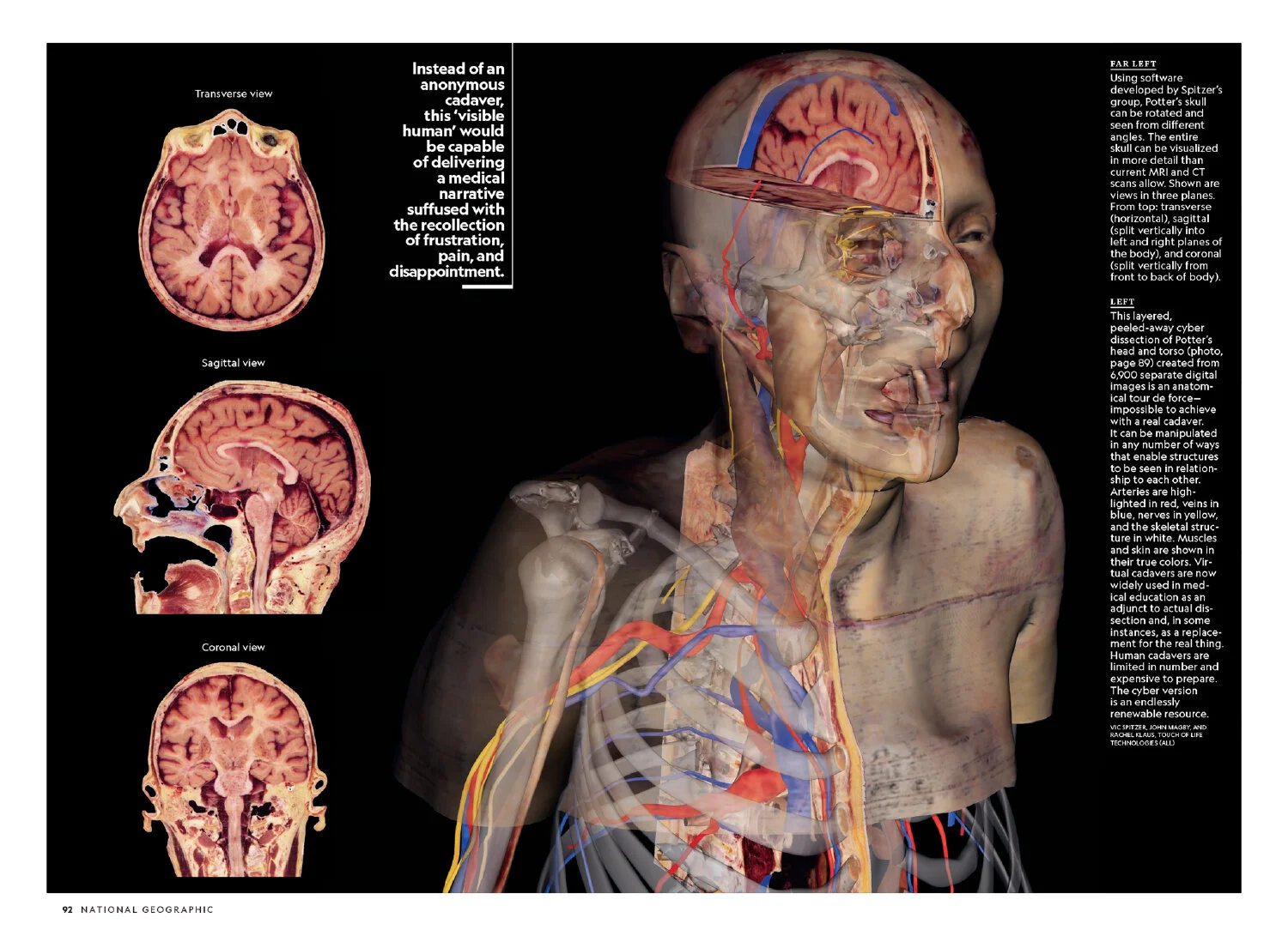 Layout_Visual Human_MM7202 [P];44_SpNB-13.JPG