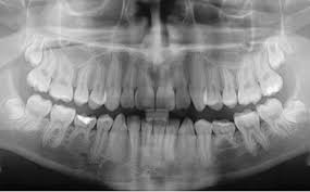 digital-xray.jpg
