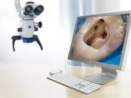 dental-microscope-in-endodontics.jpg