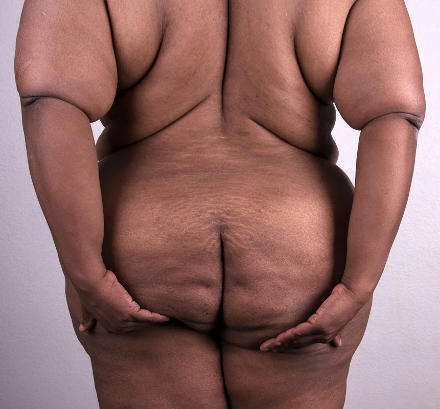 Erica-Cupping-Large-copy.jpg