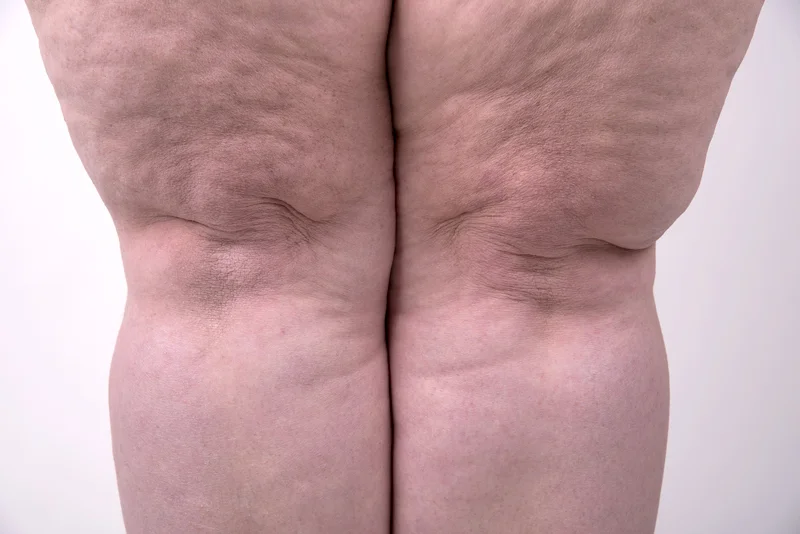 Helen-Knees.jpg