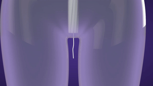 17198946_10158255486435507_193463188_n.gif