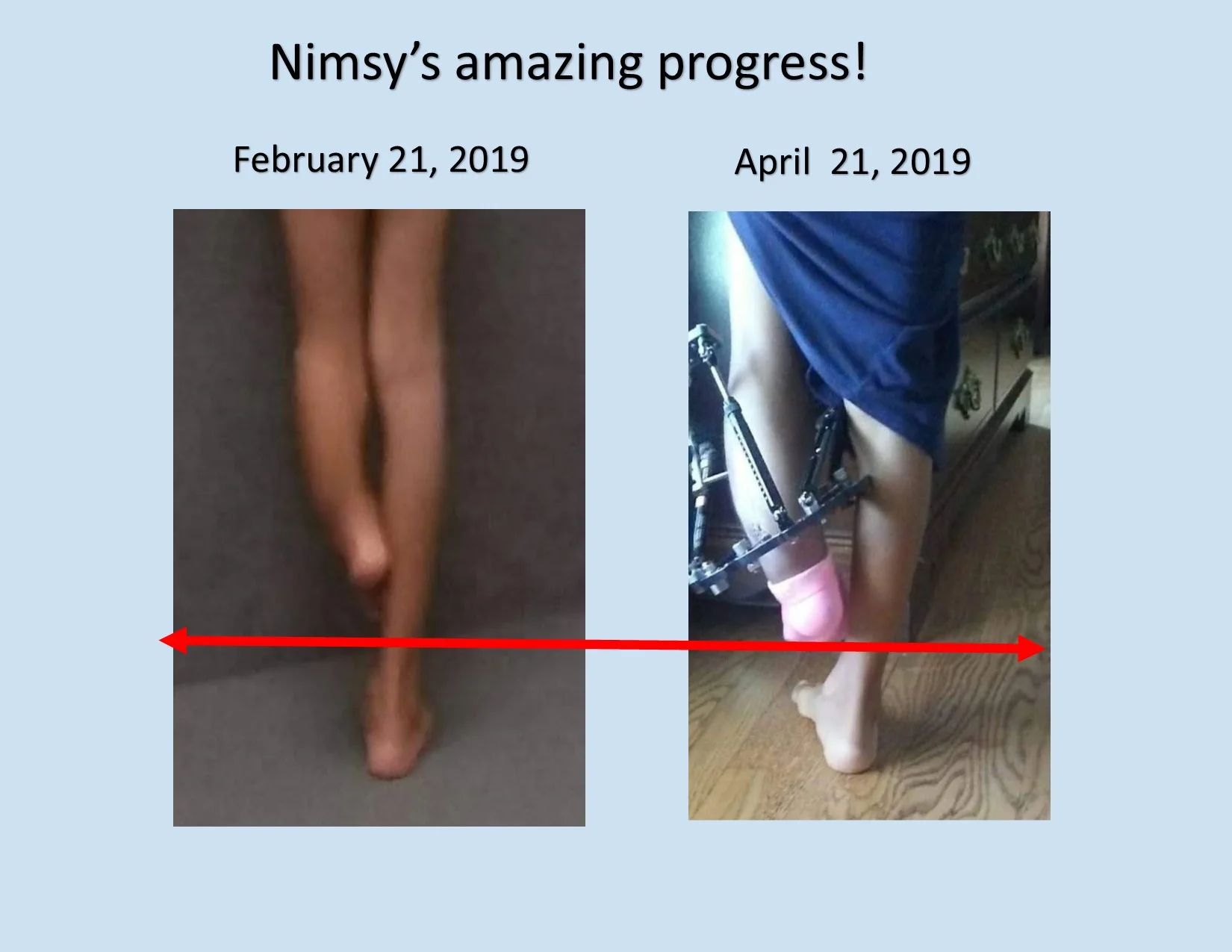Nimsy amazing progress.jpg