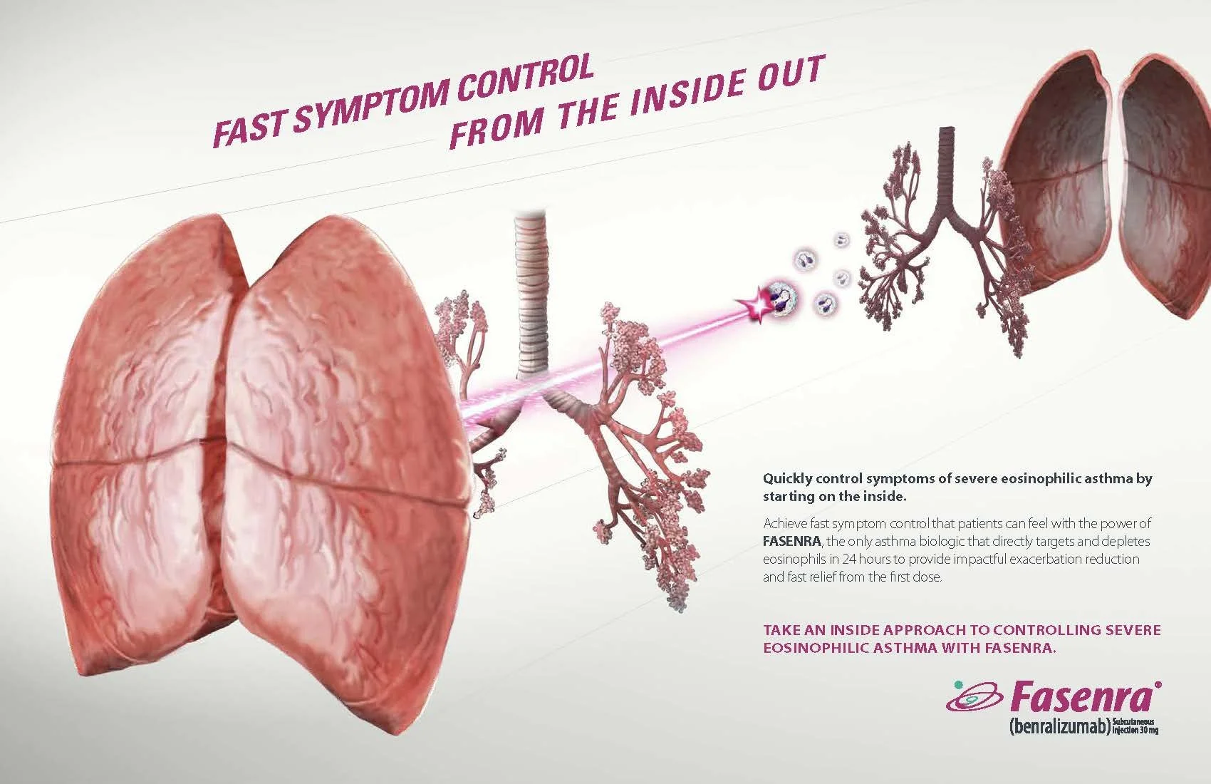 FASENRA_GLOBAL_campaign_evolution_PRESENTATIONV4_Page_18.jpg