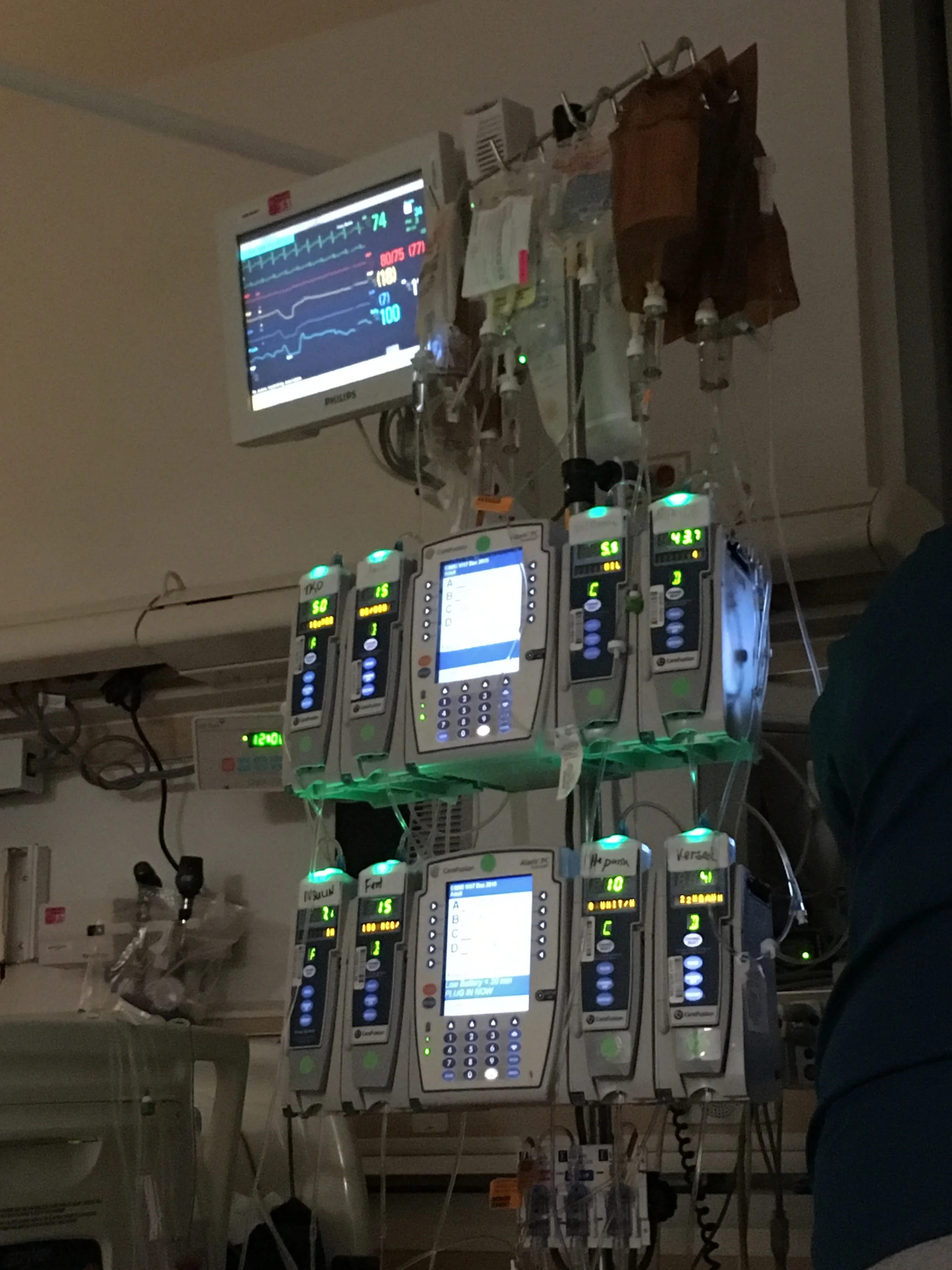  IVs on IVs. The nurses juggled lots of medicine in the ICU. 