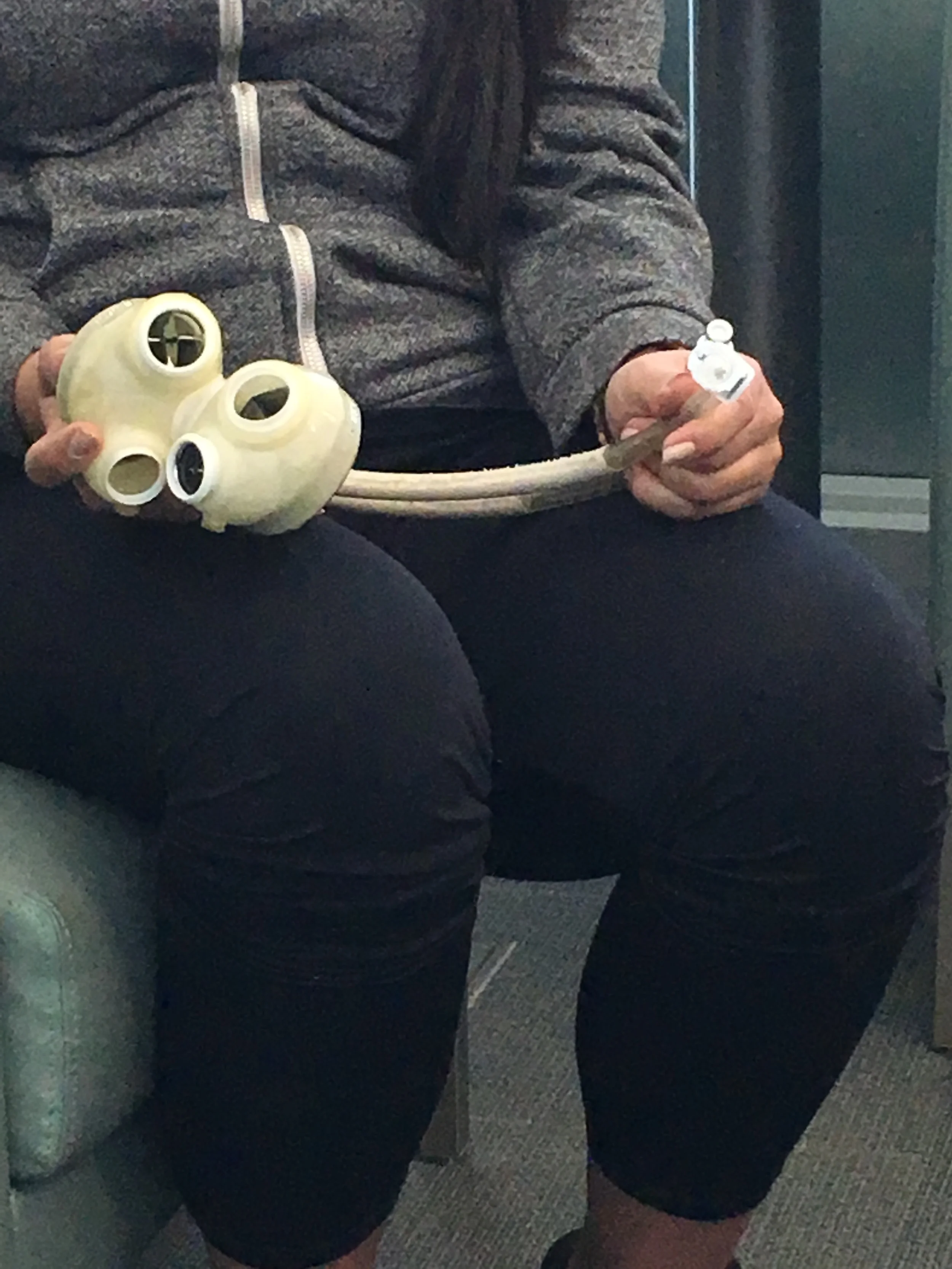  Our first encounter with the Total Artificial Heart device 