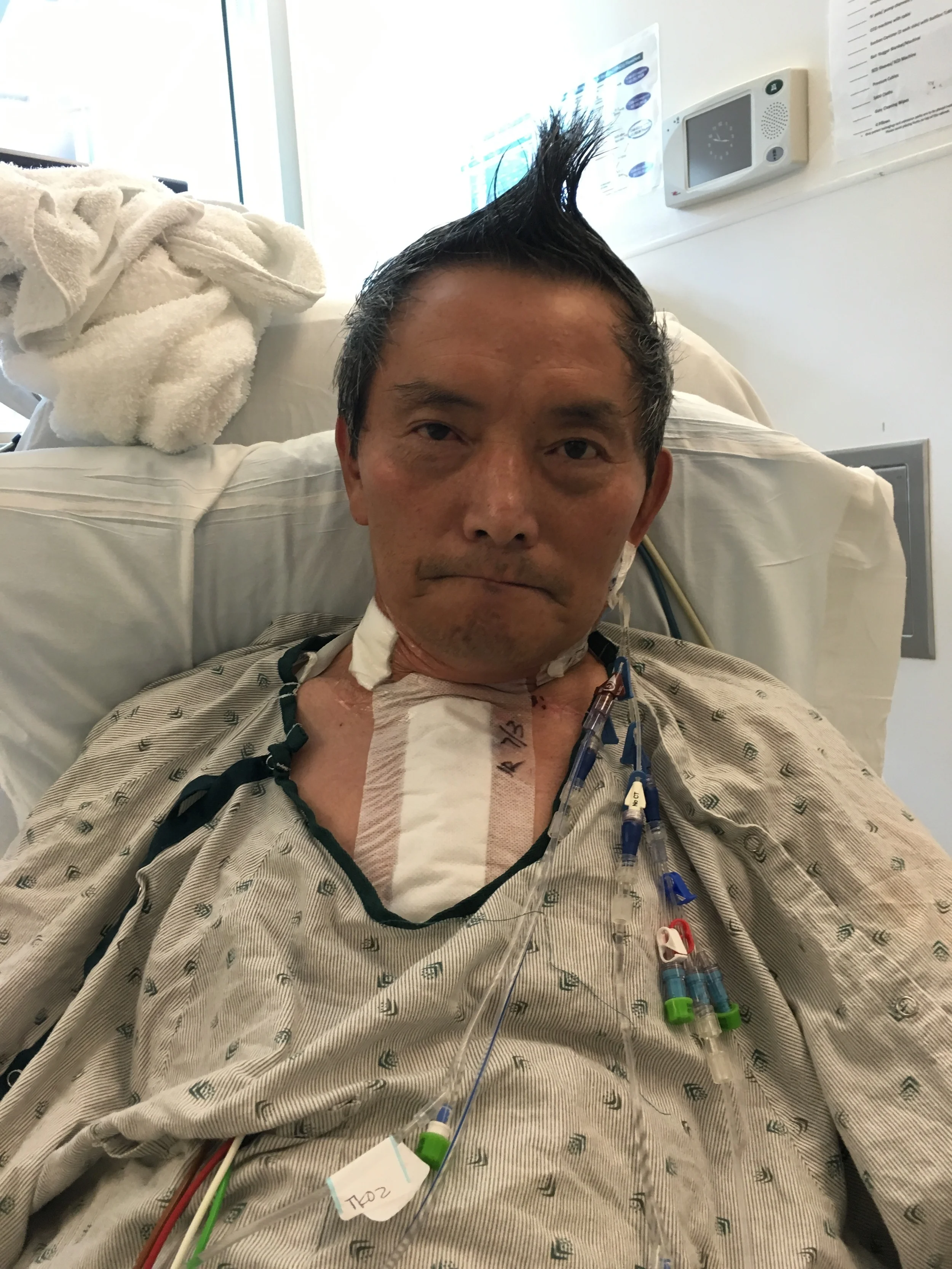 Styling Fun in the ICU, Post Transplantation Surgery