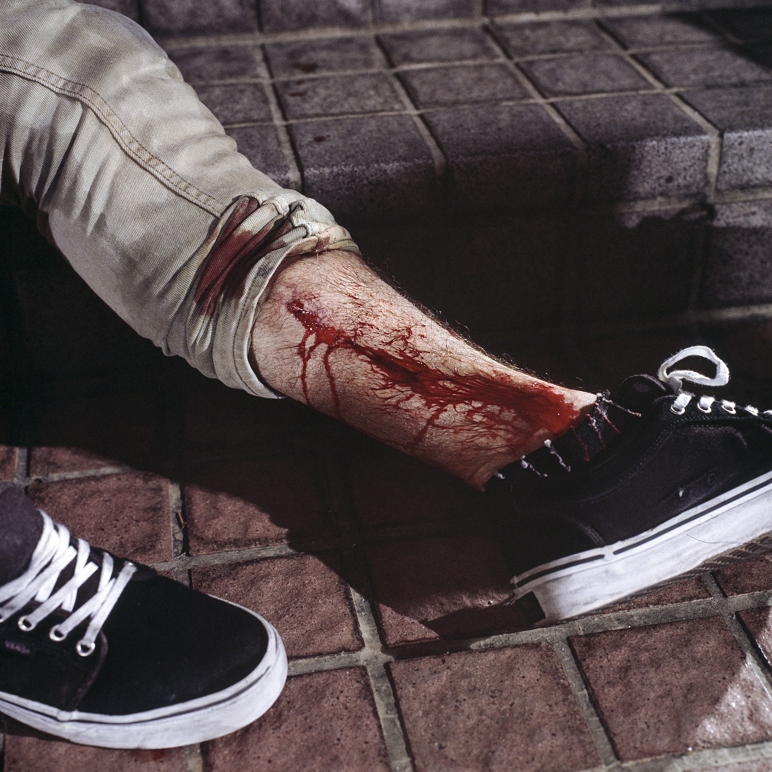 blood_shed.jpeg