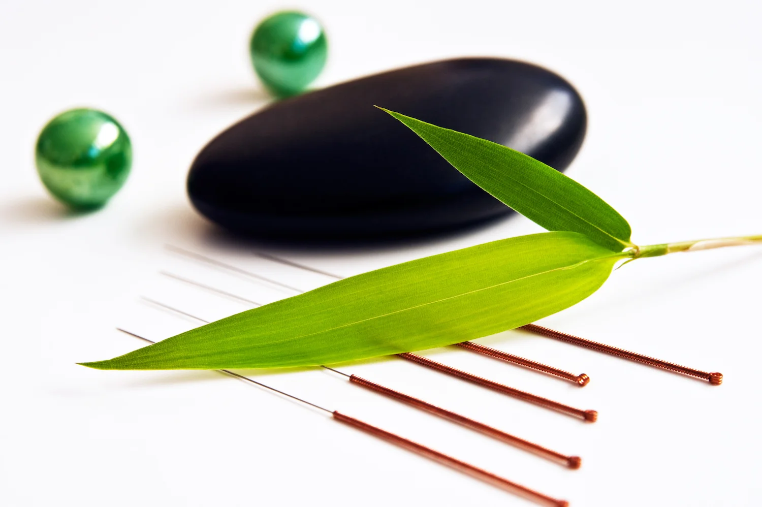 acupuncture-1.jpeg