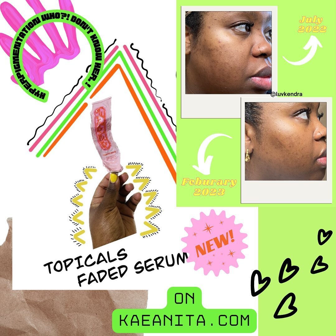 hey look at me with an in feed post on my instagram about a new blog post. Who is she?! Anyway, I posted a review about my year long use of @topicals Faded serum. You should read it. Also shoutout my estheti-bestie @hello.pure.elegance for her assist