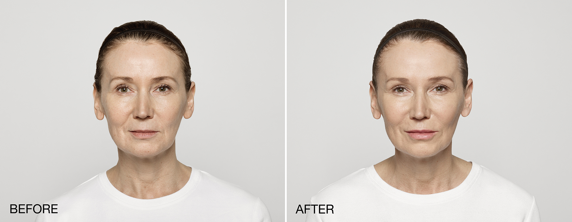 Before and After Front