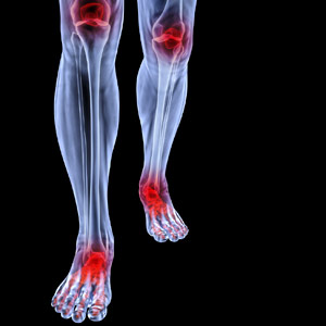 Biomechanical Evaluation and Custom Orthotics
