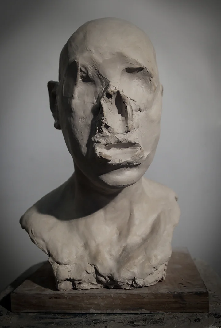 Disambiguation ( s ide view), 2015 .