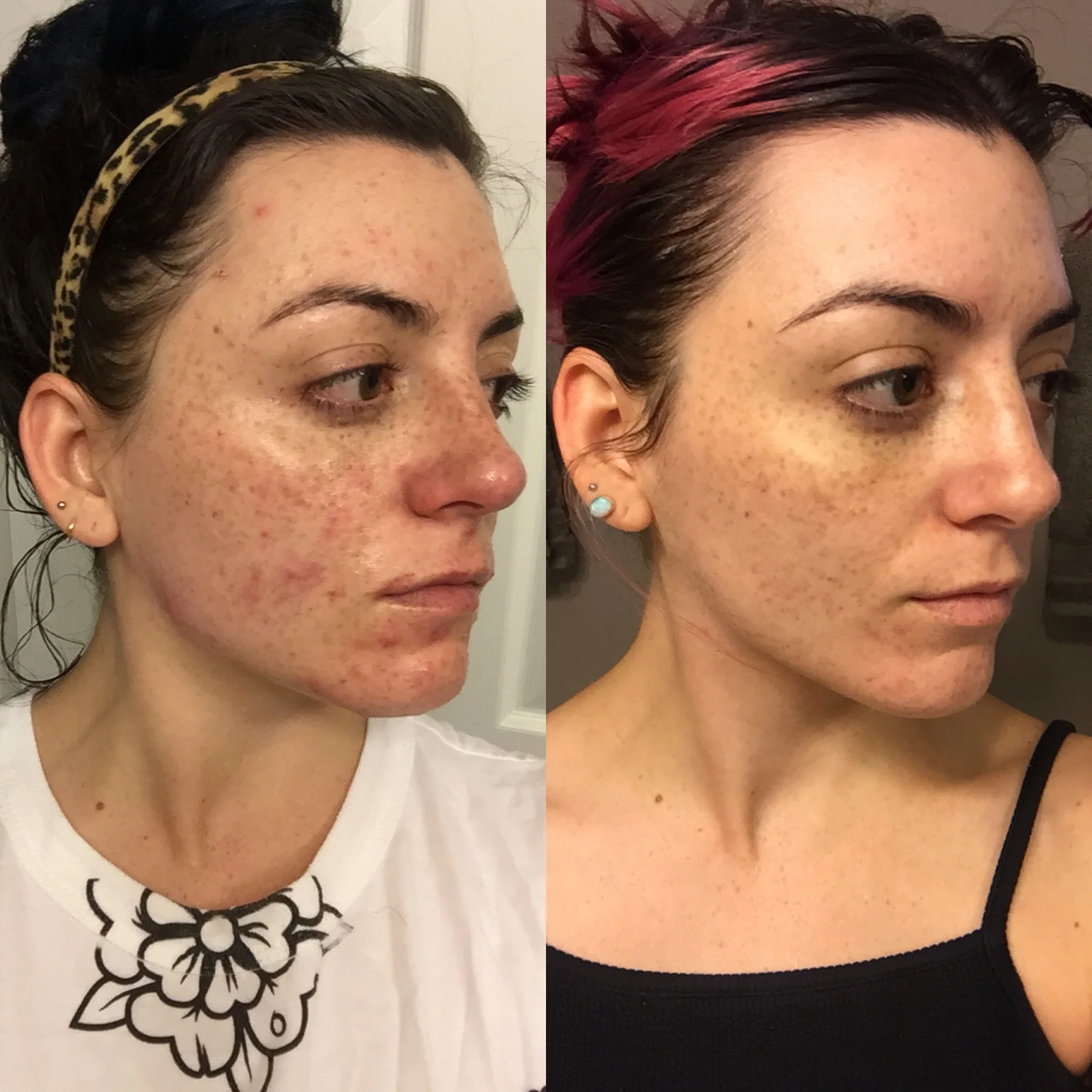 emma hardie midas touch revitalising eye serum