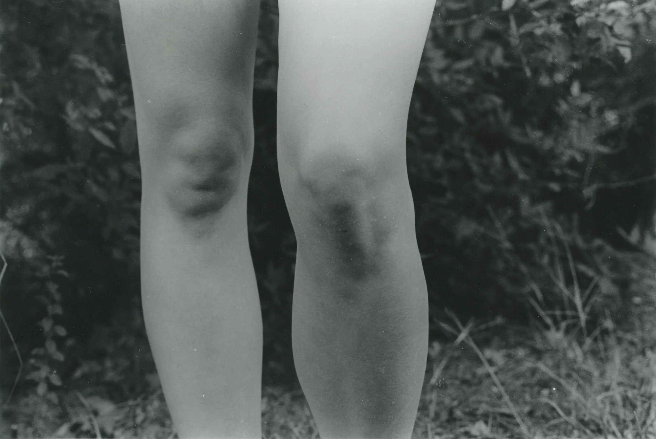 Lydia Turbeville_knees.jpg