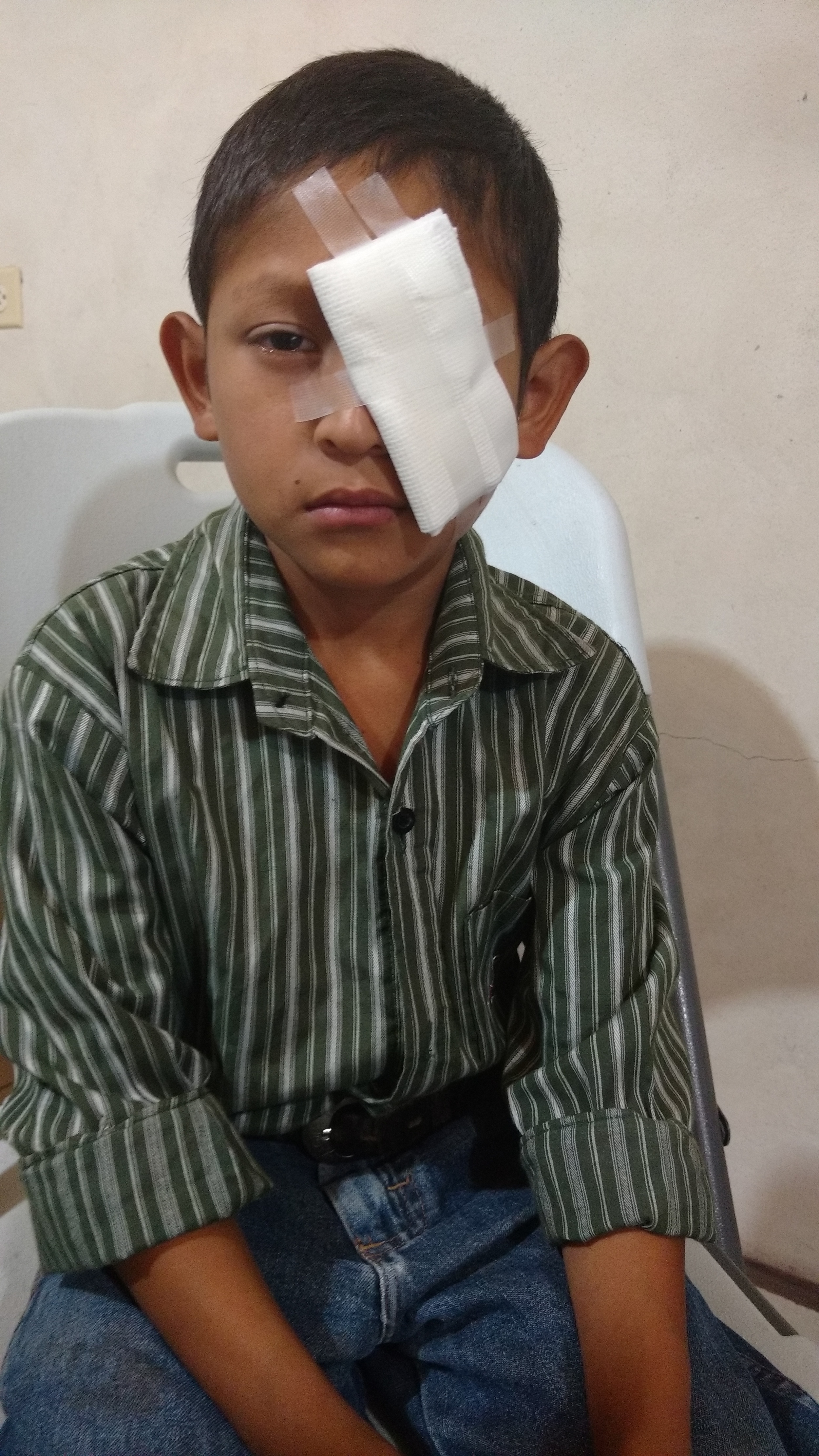 This young man was referred for urgent Ophalmology assessment after an injury to his eye. We made him an eye patch, as he had become very sensitive to light.