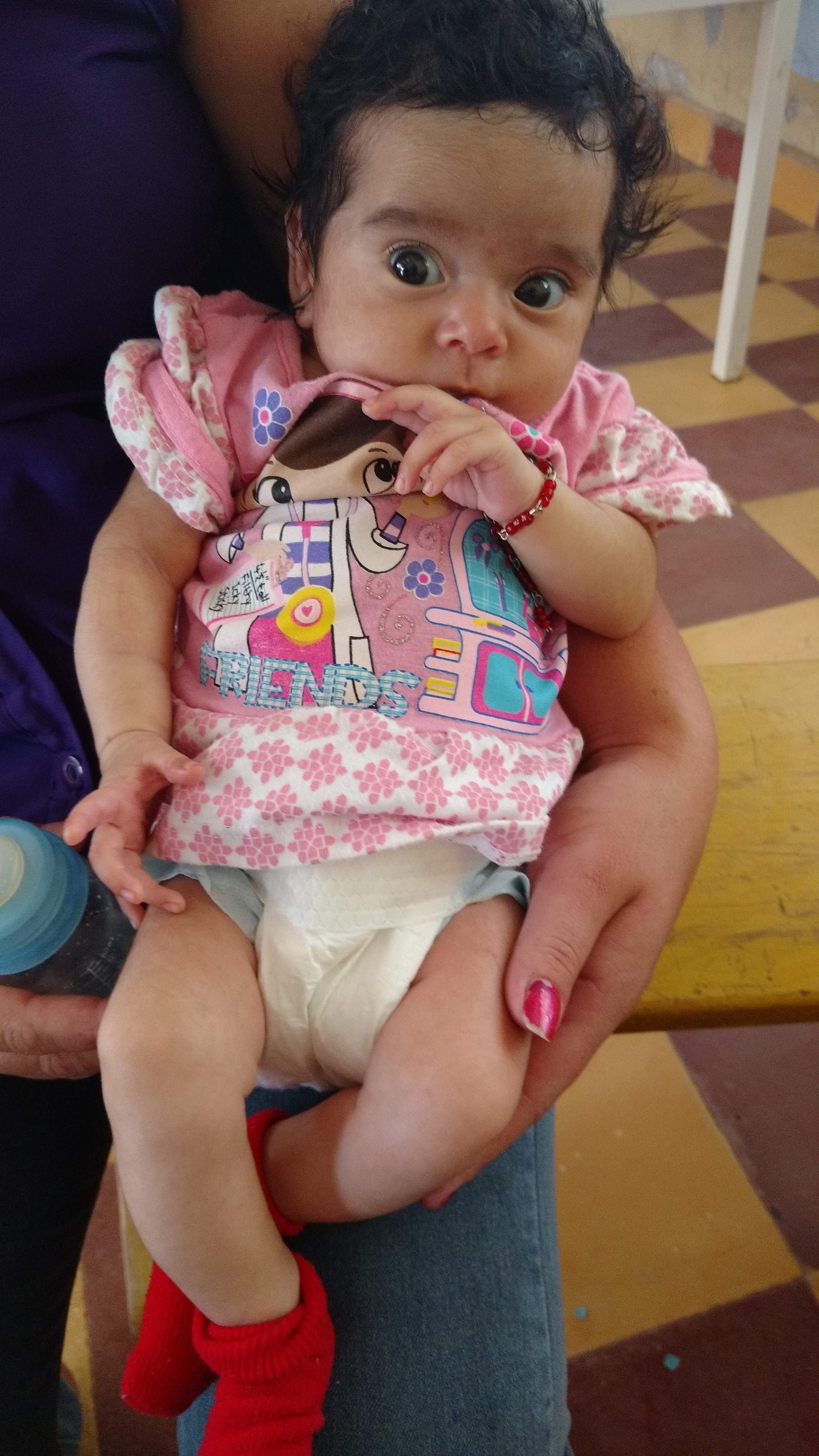 This adorable 2 month old, developmentally normal girl presented with low weight. 
