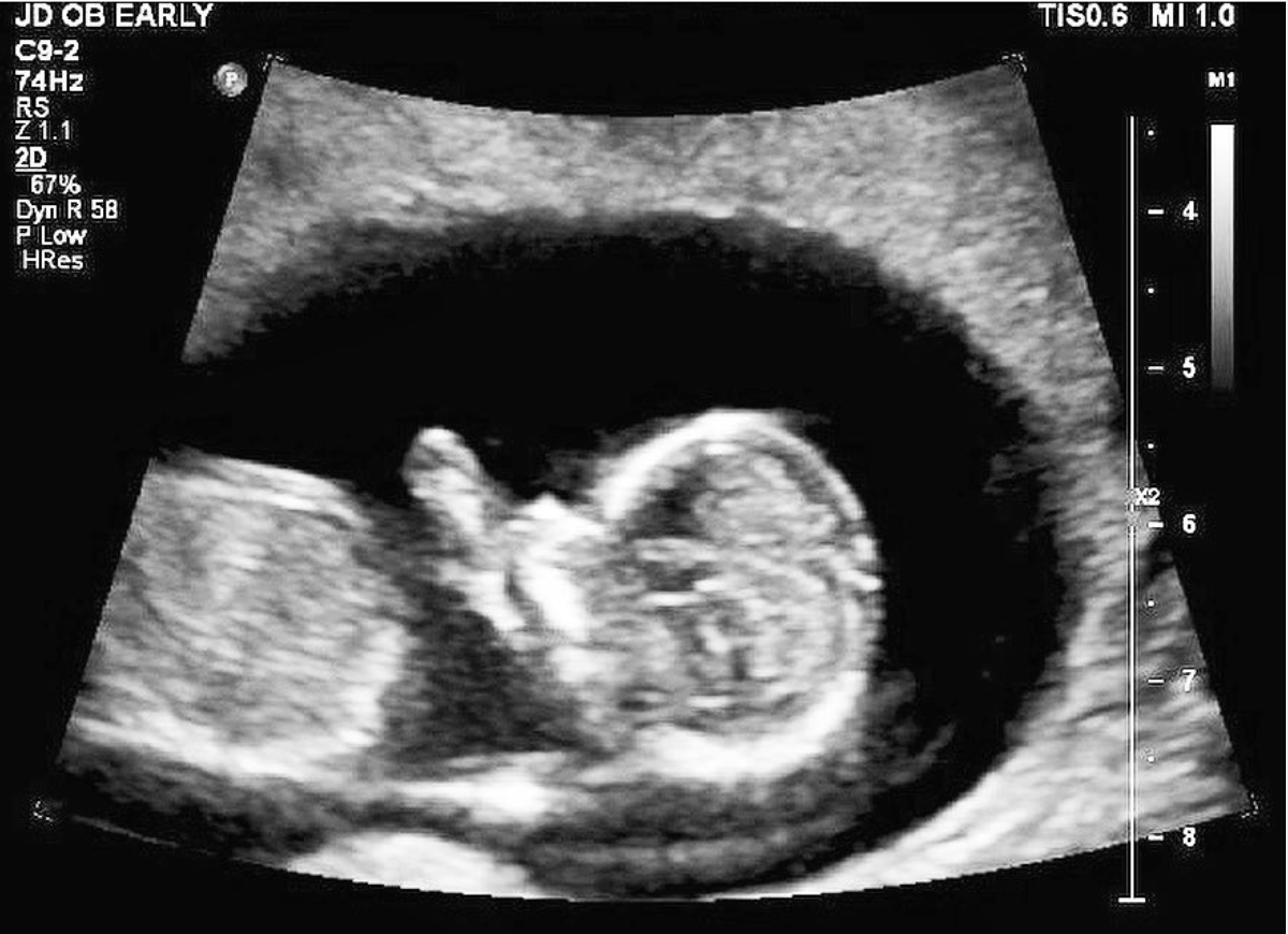 Screen Shot 2019-04-01 at 3.58.39 pm.png