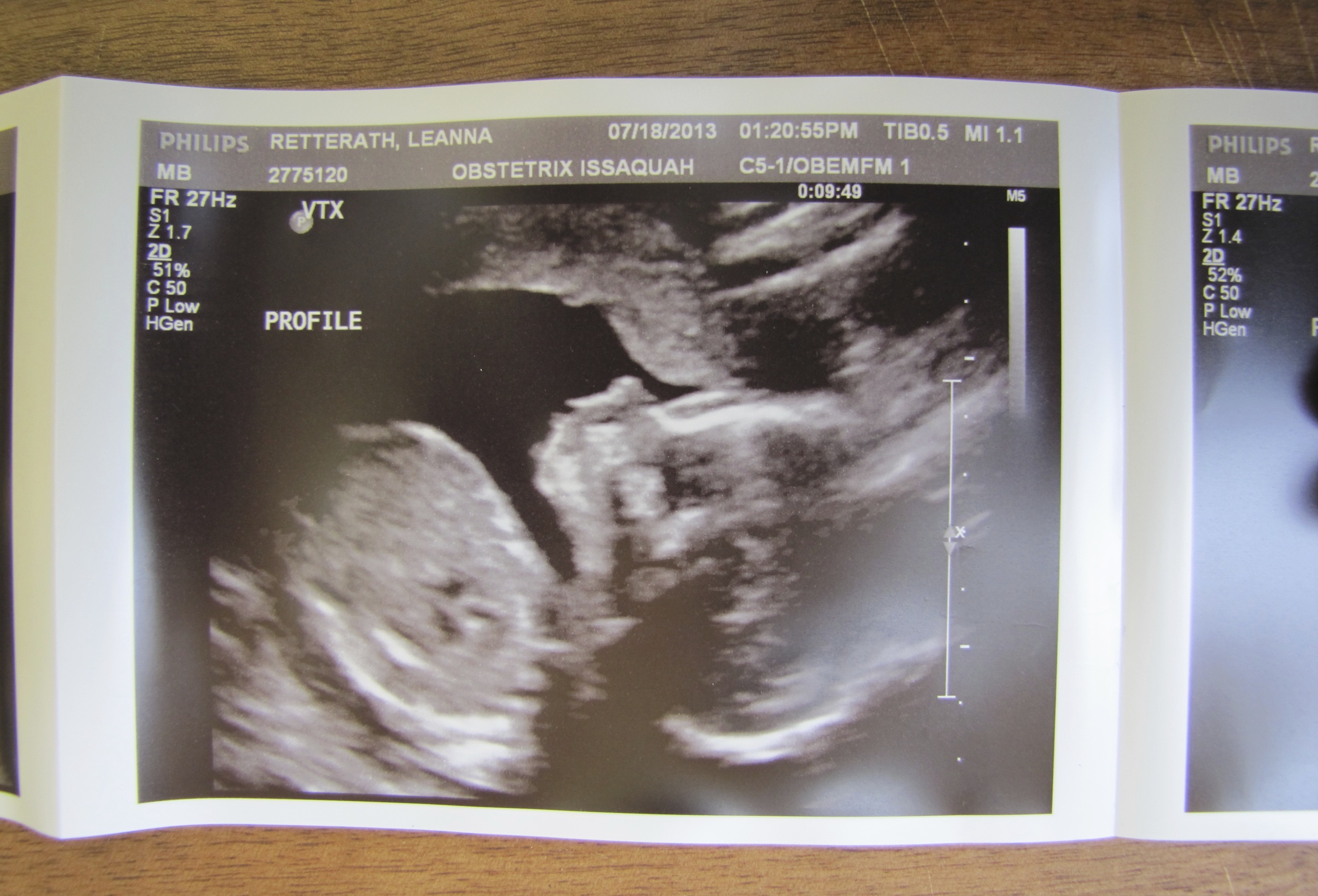 UTS1- Baby Profile 3.jpg