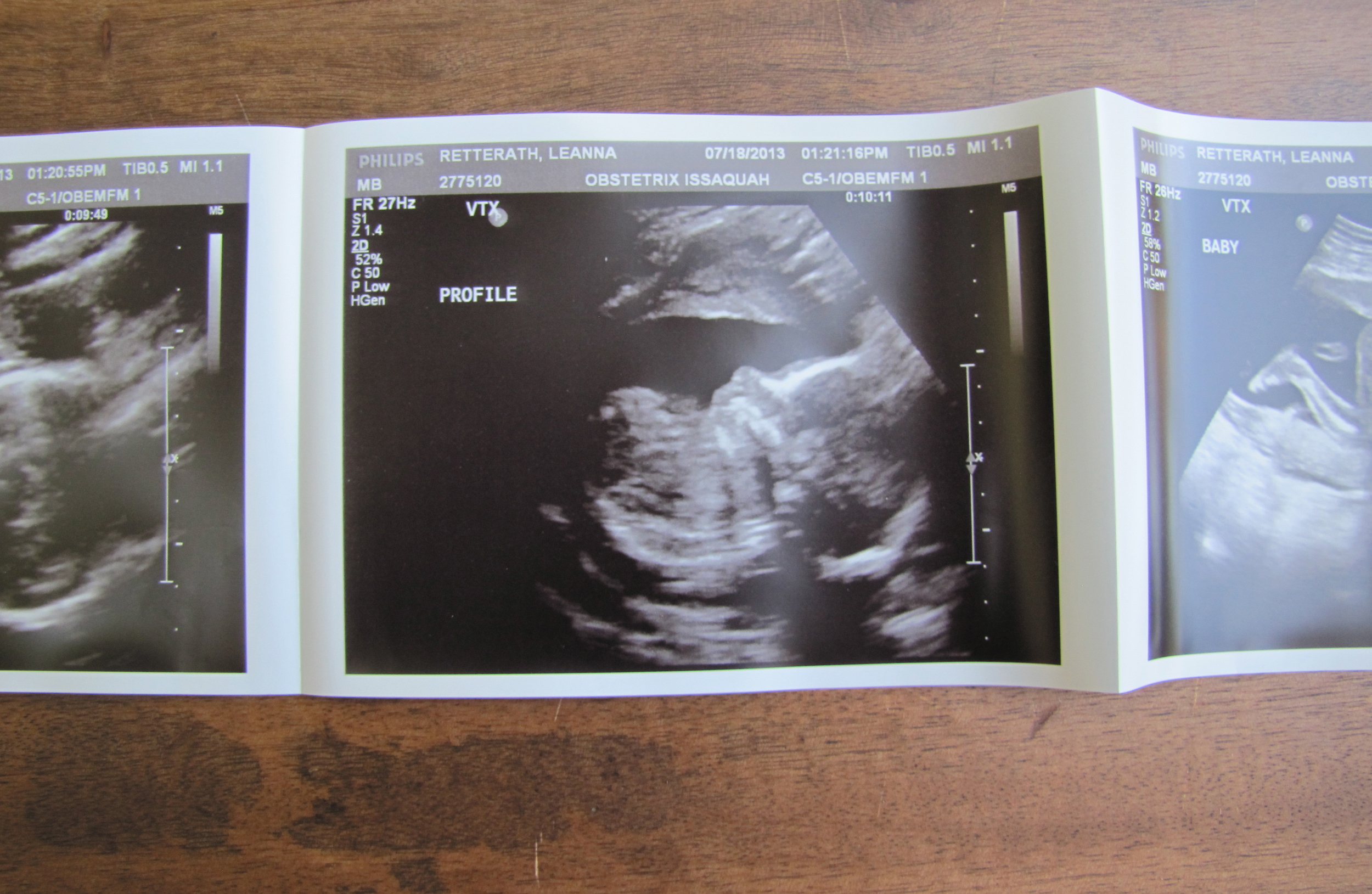 UTS1- Baby Profile 2.jpg
