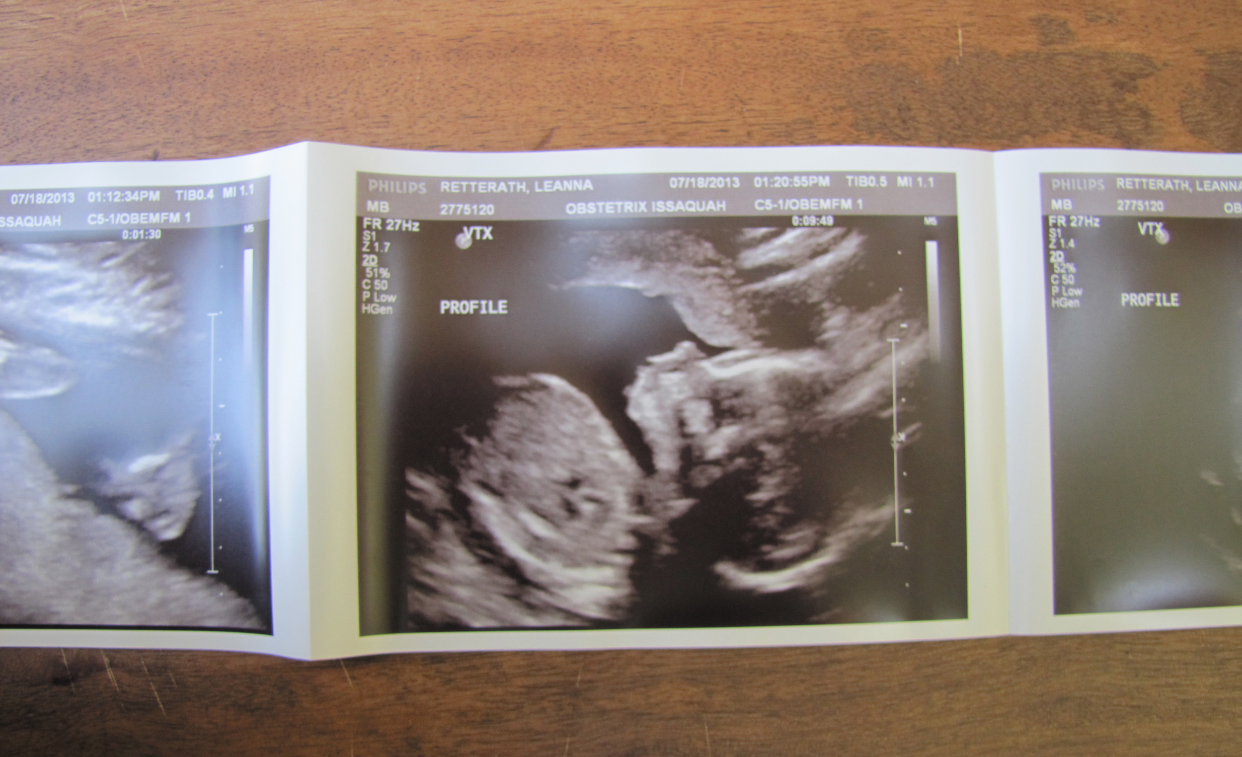 UTS1- Baby Profile 4.jpg