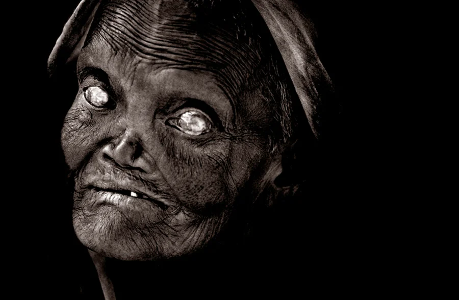 cataracts.jpg