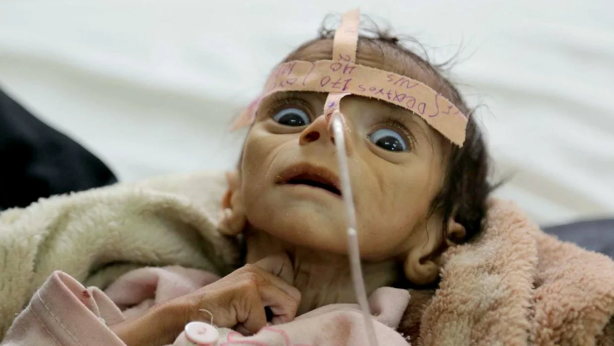 starving-baby-yemen.jpg