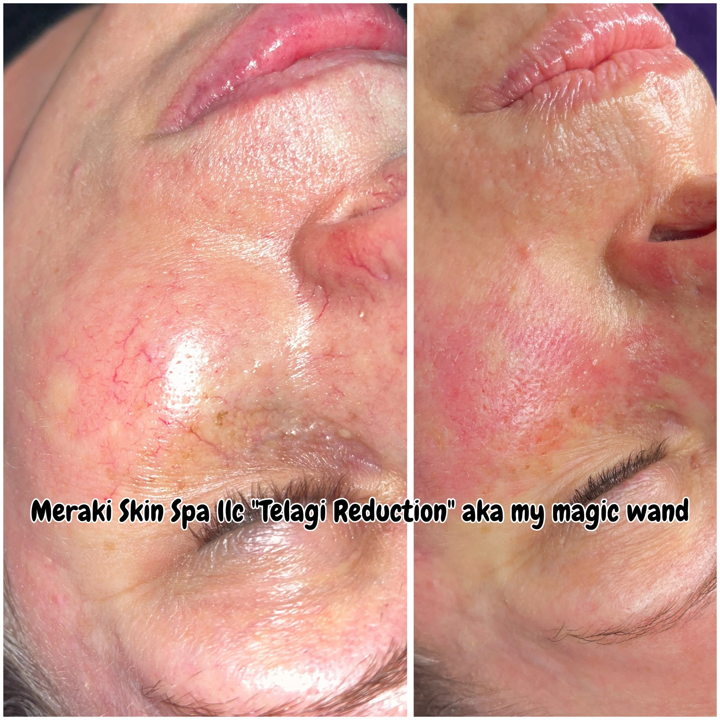 Meridian Idaho-day spa-med spa-skin care treatment-corrective facials-permanent makeup- tattooed eyeliner-micro blading-eyelash extensions-micro needling-chemical peels-lash lift-brow lamination-Eagle Idaho-Boise Idaho-PCA Skin-face vein removal