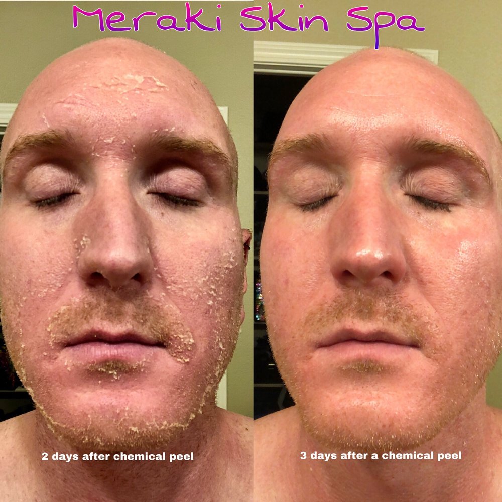 Skin Spa