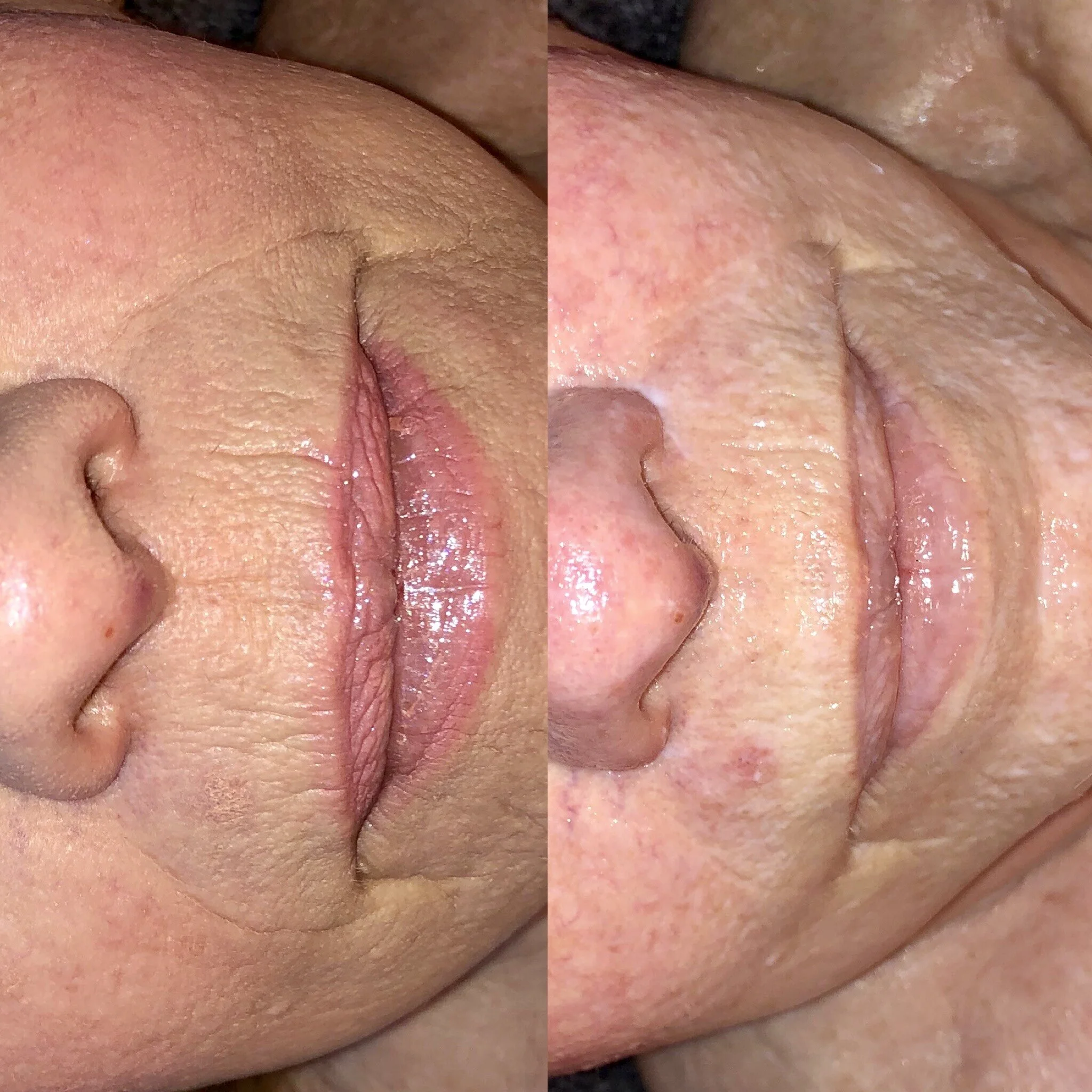 Best anti aging facial near me meridian idaho, med spa day spa, hydrating facial, facial for older women, pca skin care, facial for men, wrinkle reduction