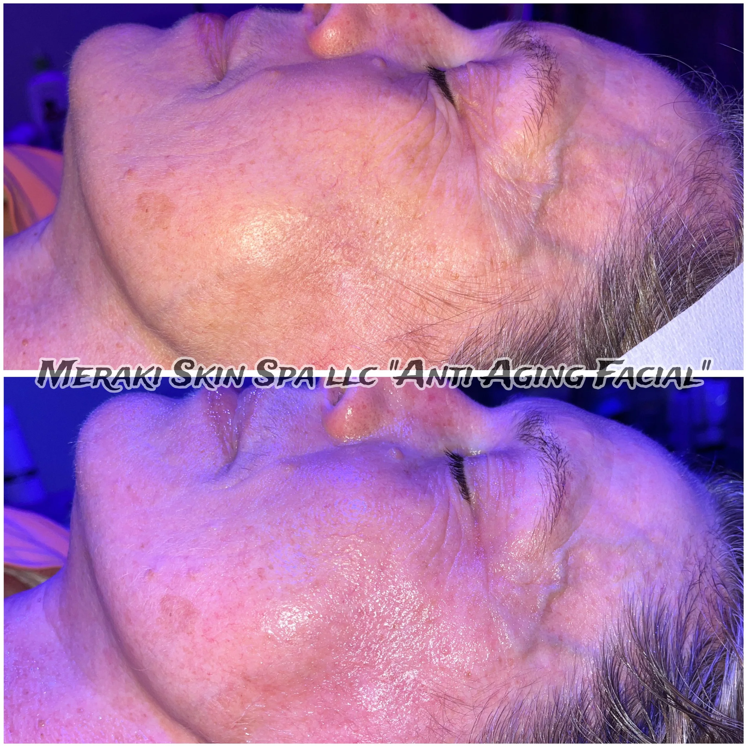 Meridian Idaho-day spa-med spa-skin care treatment-corrective facials-permanent makeup- tattooed eyeliner-micro blading-eyelash extensions-micro needling-chemical peels-lash lift-brow lamination-Eagle Idaho-Boise Idaho-PCA Skin-Esthetician near me