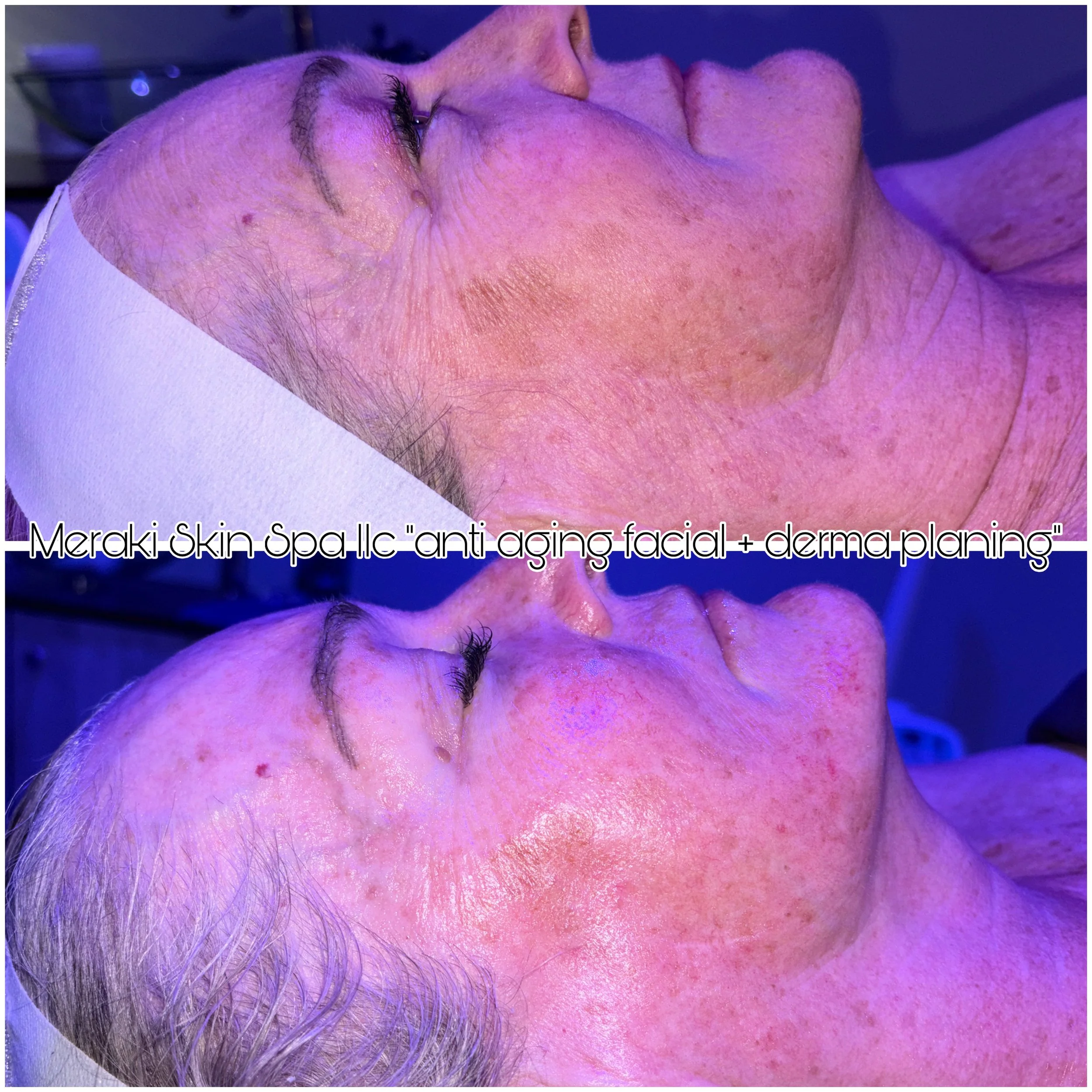 dermaplaning facial and lash lift meridian idaho day, spa, best facial near me, anti aging facial, treatment for wrinkles