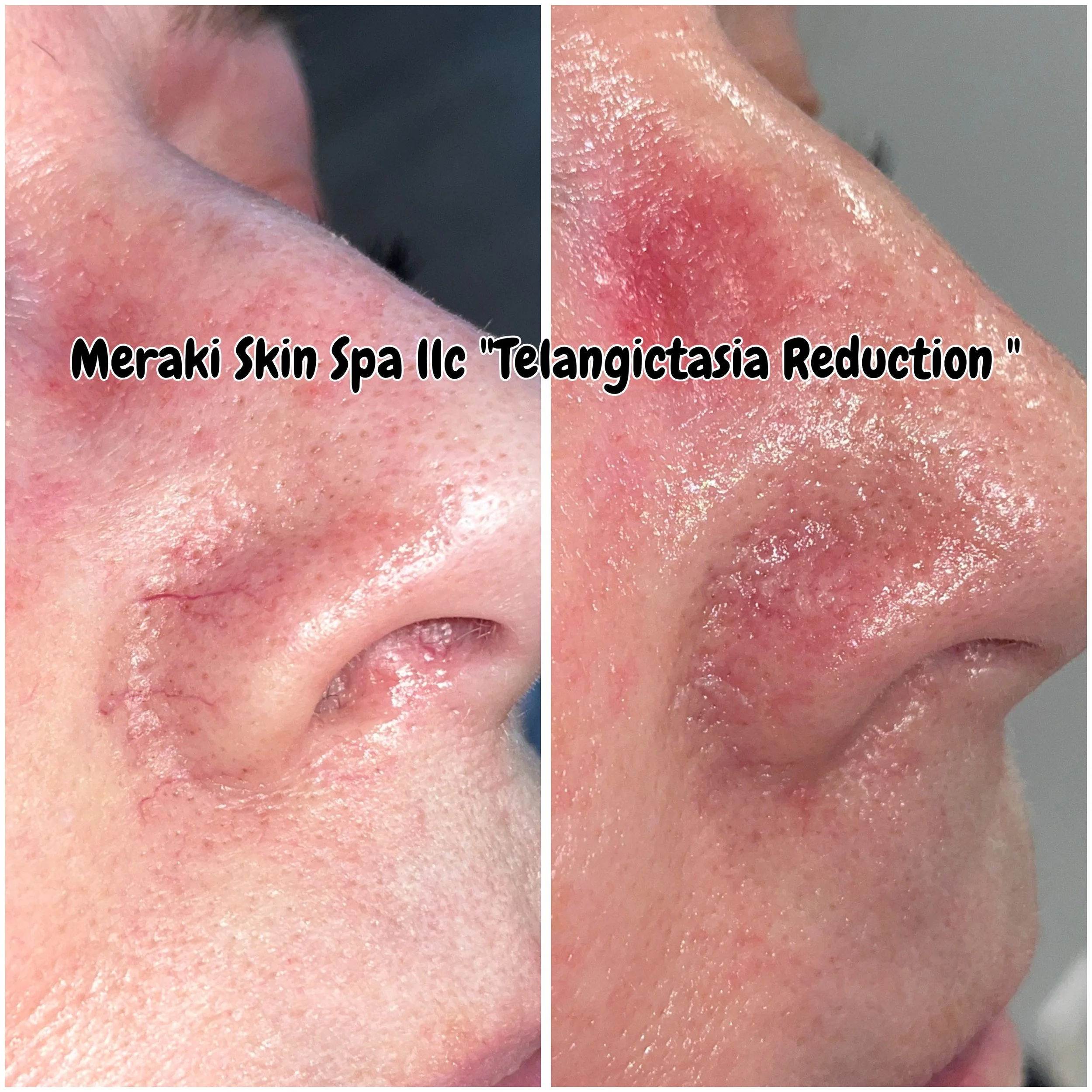 Meridian Idaho-day spa-med spa-skin care treatment-corrective facials-permanent makeup- tattooed eyeliner-micro blading-eyelash extensions-micro needling-chemical peels-lash lift-brow lamination-Eagle Idaho-Boise Idaho-PCA Skin-Esthetician near me