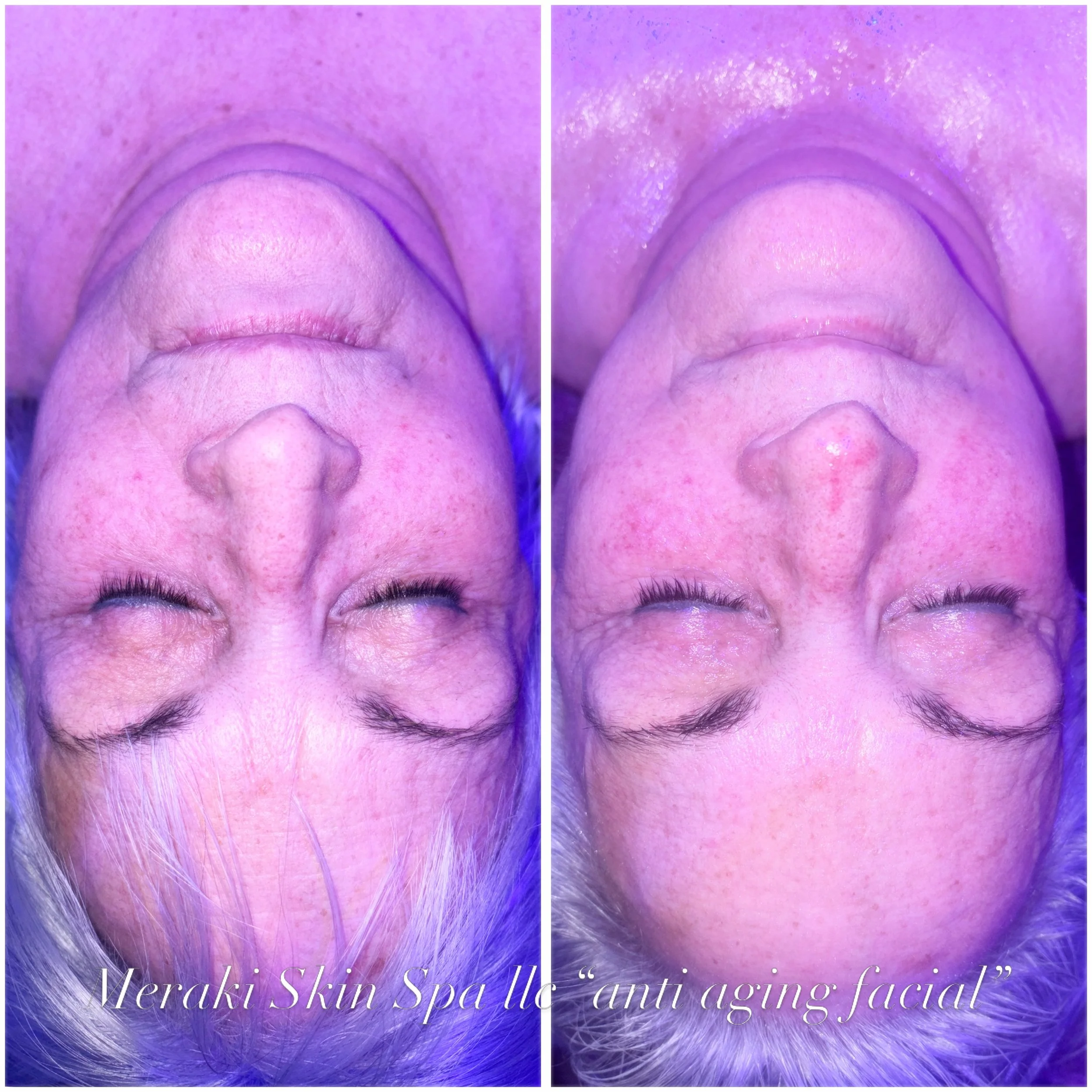 Meridian Idaho-day spa-med spa-skin care treatment-corrective facials-permanent makeup- tattooed eyeliner-micro blading-eyelash extensions-micro needling-chemical peels-lash lift-brow lamination-Eagle Idaho-Boise Idaho-PCA Skin-Esthetician near me