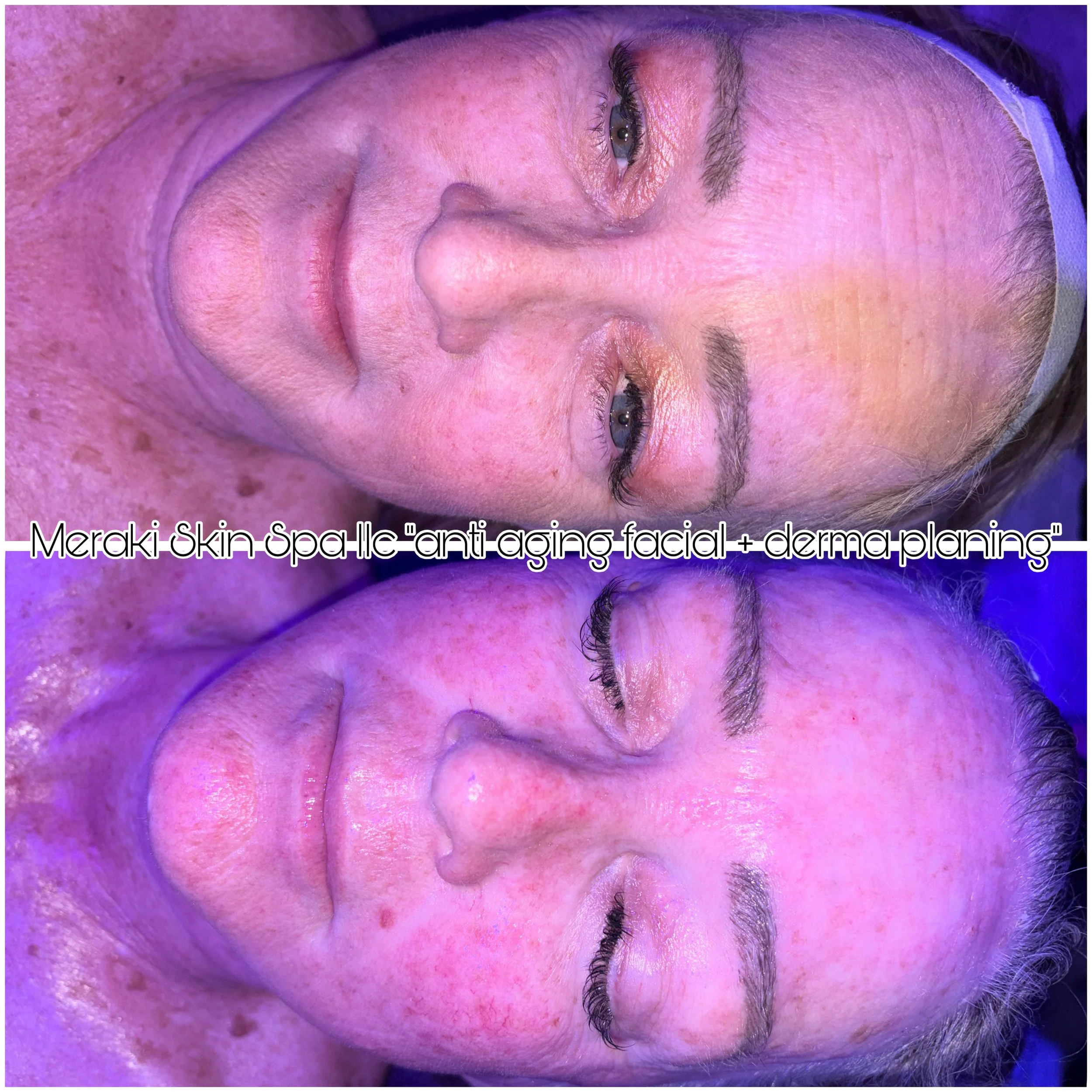 dermaplaning facial and lash lift meridian idaho day, spa, best facial near me, anti aging facial, treatment for wrinkles