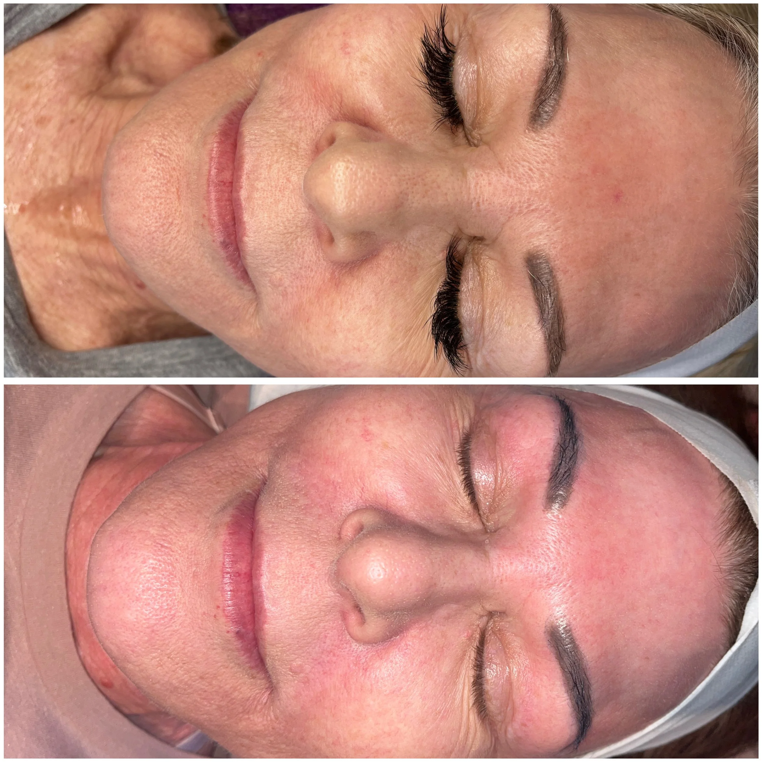 Meridian Idaho-day spa-med spa-skin care treatment-corrective facials-permanent makeup- tattooed eyeliner-micro blading-eyelash extensions-micro needling-chemical peels-lash lift-brow lamination-Eagle Idaho-Boise Idaho-PCA Skin-Esthetician near me