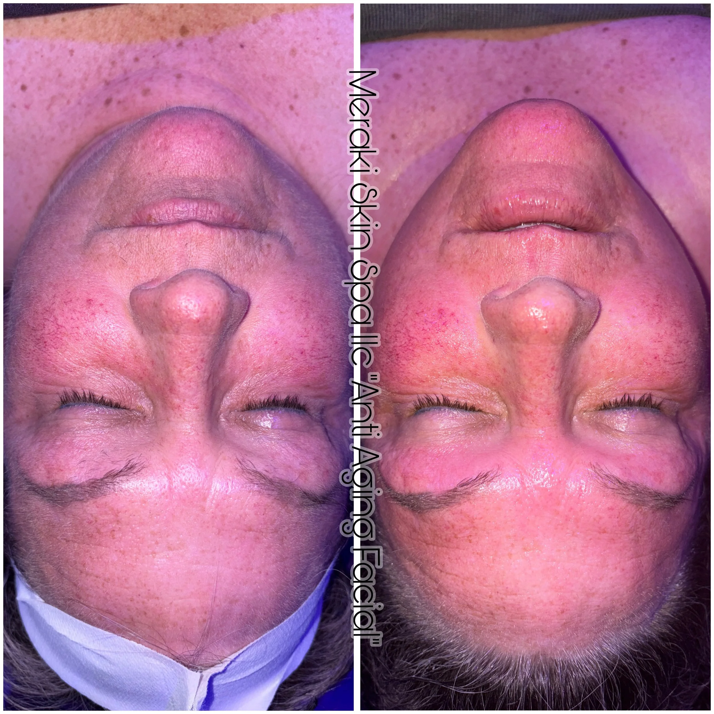 chemical peel facial and lash lift meridian idaho day, spa, best facial near me, anti aging facial, treatment for wrinkles