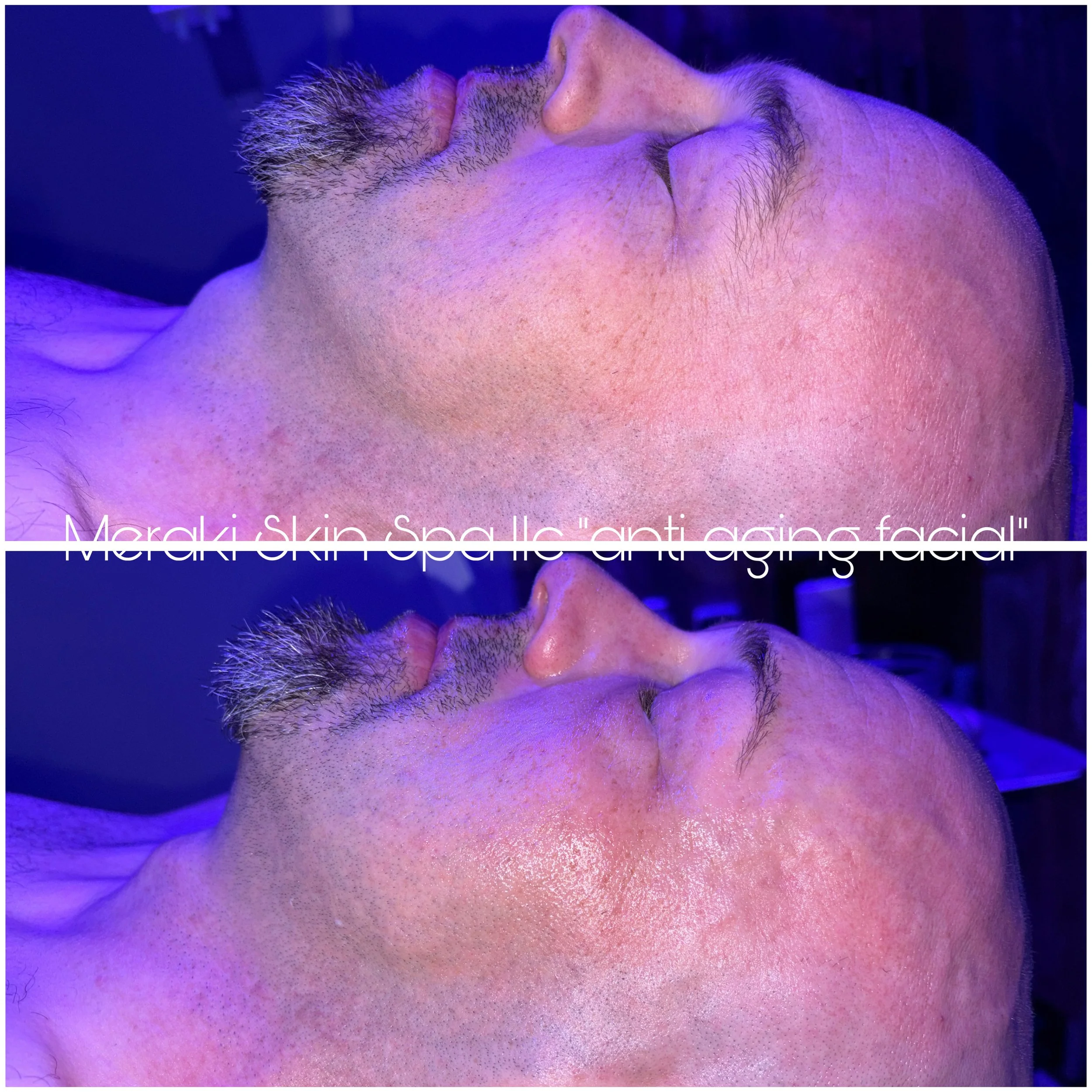 facial and lash lift meridian idaho day, spa, best facial near me, anti aging facial, treatment for wrinkles